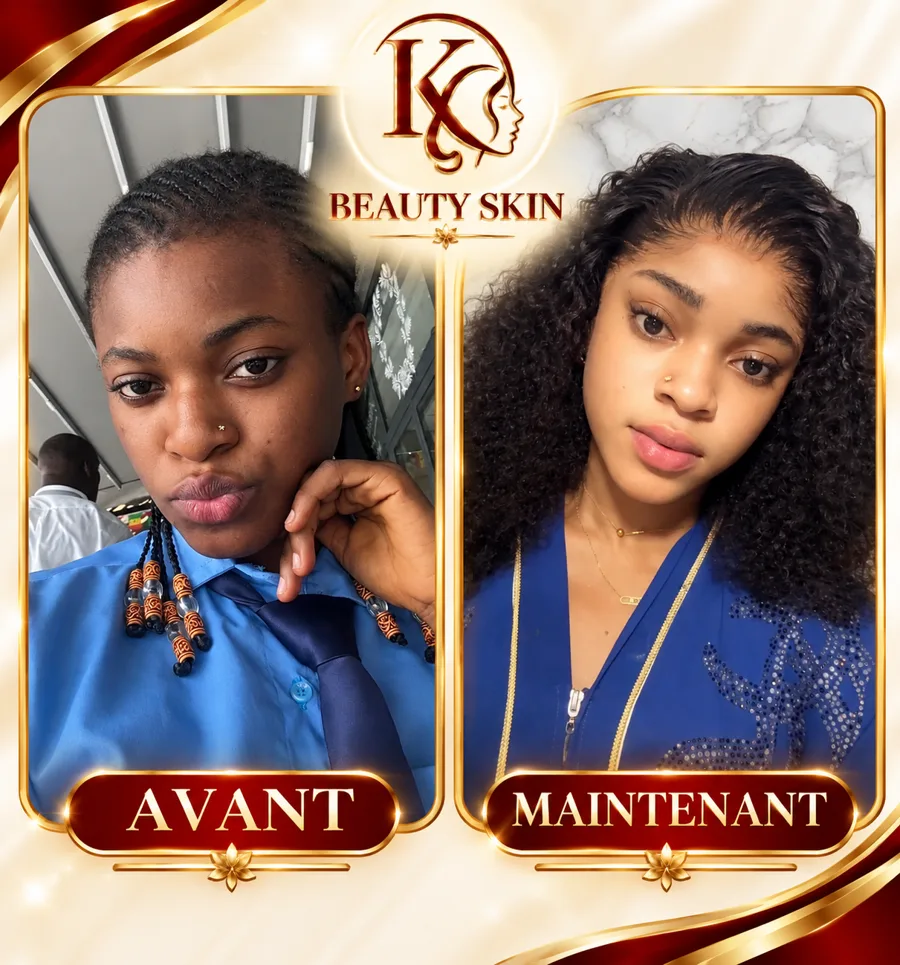 Témoignage cliente KK Beauty House — avant/après