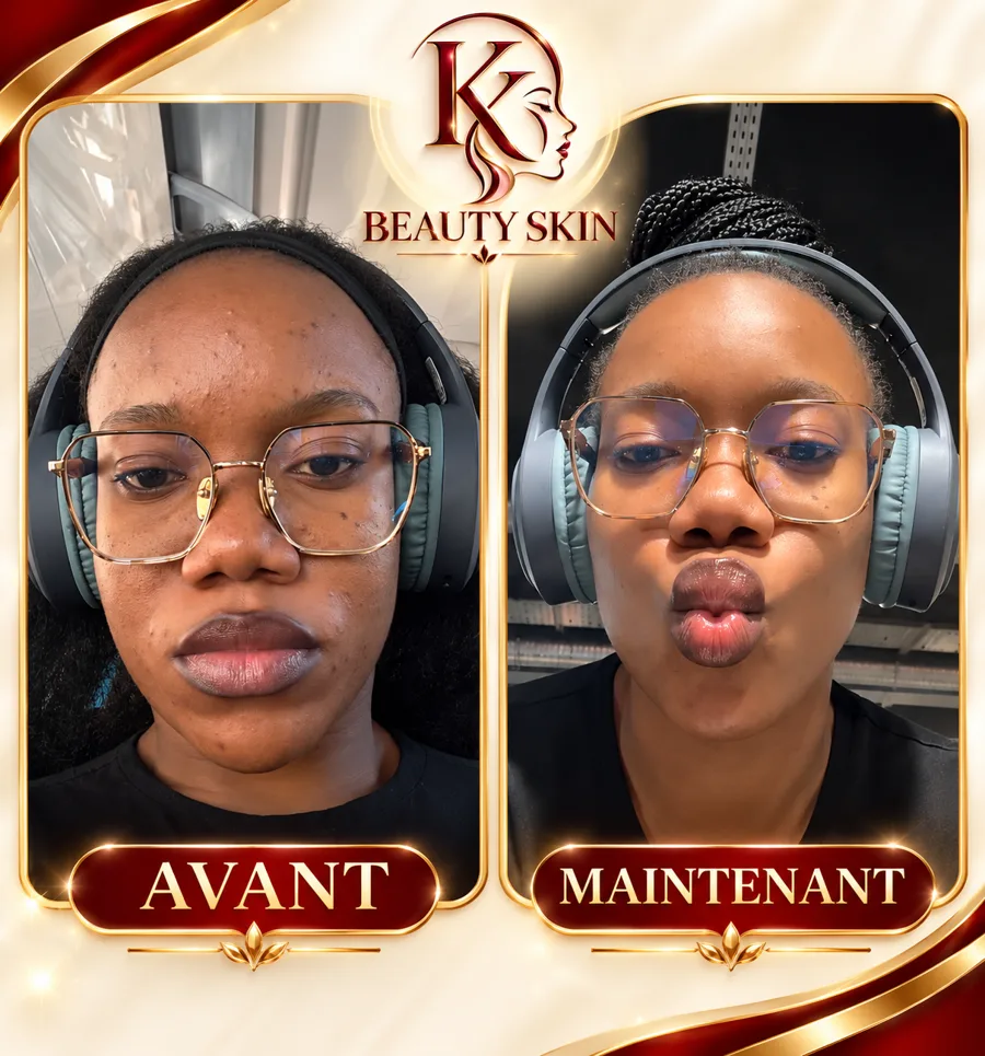 Témoignage cliente KK Beauty House — avant/après