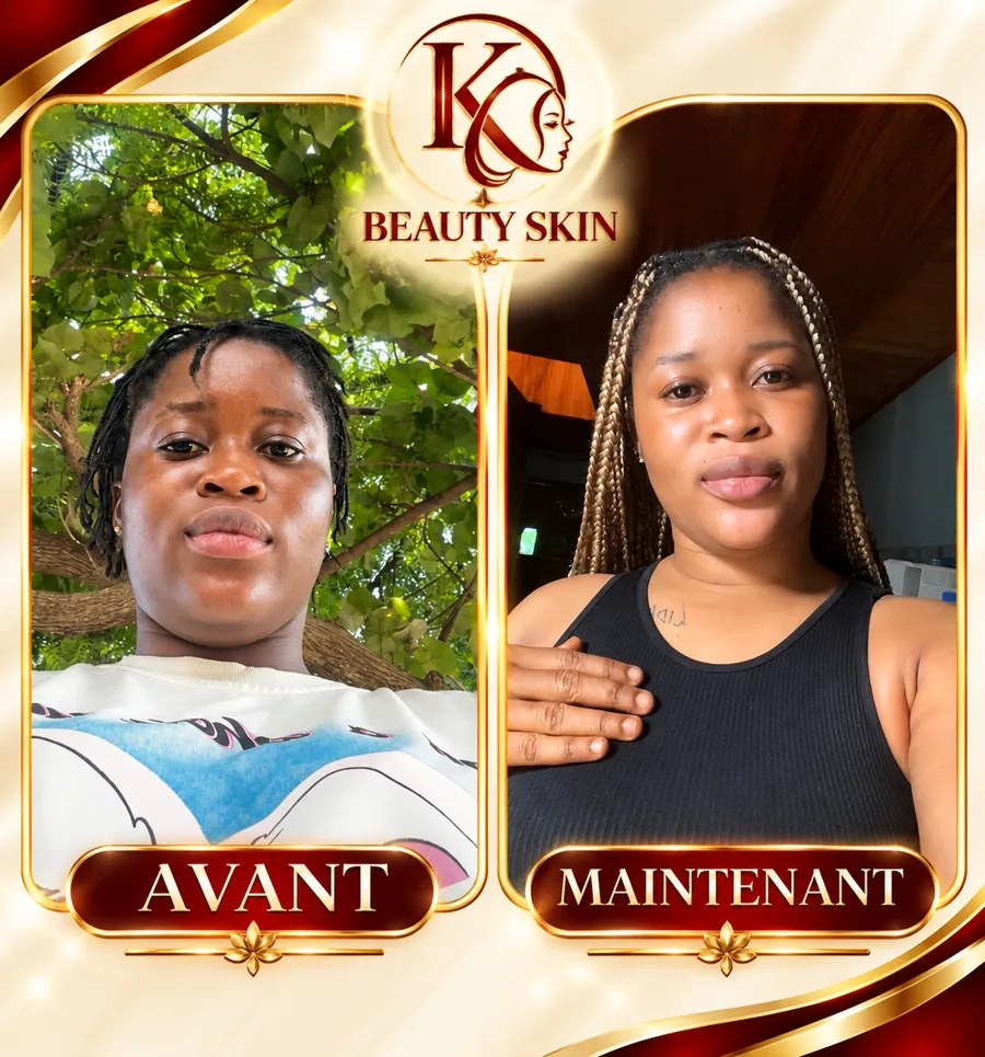 Témoignage cliente KK Beauty House — avant/après