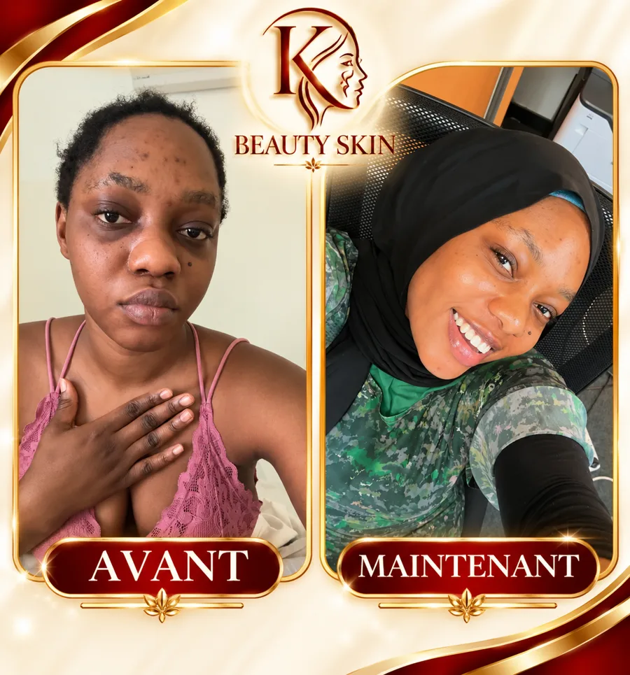 Témoignage cliente KK Beauty House — avant/après